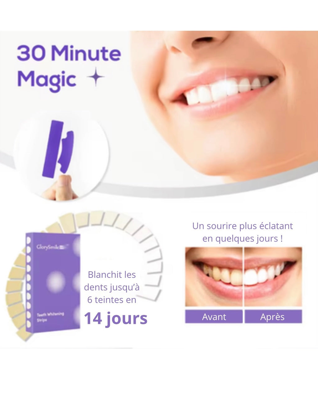 Bandes de blanchiment Glorysmile